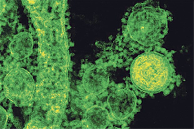 Mit neuer Plattformtechnologie zu einem Impfstoff Elektronenmikroskopische Aufnahme von Partikeln des Mers-Coronavirus außerhalb der Zelle (Virionen).