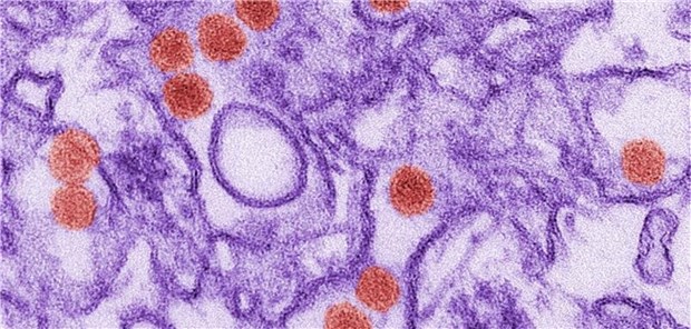 Deshalb ist die Zika-Diagnostik so tückisch Elektronenmikroskopische Aufnahme von Zika-Viruspartikeln (rot).