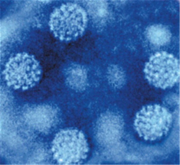 Mit HPV-basiertem Screening gibt es weniger Zervixkrebs Elektronenmikroskopische Aufnahme von humanen Papillomviren. Krebsauslösend sind vor allem HPV-Typ 16 und Typ 18. ©Professor Thomas Iftner