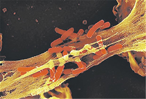 Neutrophile fangen Erreger mit Falle Elektronenmikroskopisches Bild von Shigellen (orange) in den Fängen von Granulozyten.