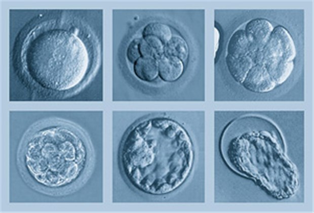 PID: Designerbabies für Ärztekammer Wesfalen-Lippe auf jeden Fall ein Tabu Embryoentwicklung in der Kulturschale nach IvF.