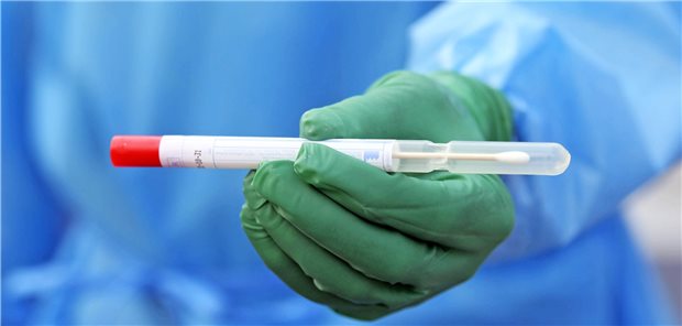 PCR-Tests: „Wir sollten nicht jeden Politikerwunsch erfüllen“ Endliche Kapazitäten nicht nur für Testkits und Reagenzien: Laborärzte fürchten, durch ungezieltes Testen Ressourcen zu vergeuden.