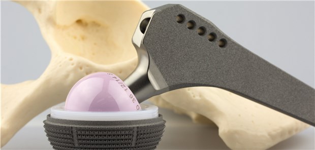 Endoprothesen mit Zink-Ionen überziehen? Diese sind für Mikroorganismen toxisch, so Studienautor Westerhausen.