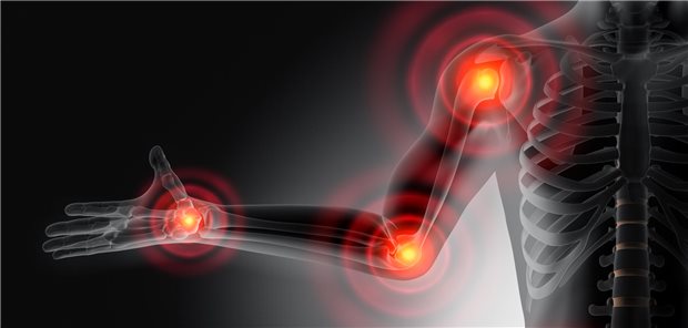 Röntgenähnliche dreidimensionale Darstellung der möglichen Gelenkschmerzpunkte bei Rheuma und Arthrose.