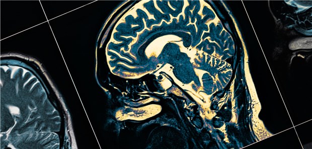 Entzündet sich die Hypophyse, weisen darauf im Vorfeld bestimmte Autoimmunantikörper hin. 