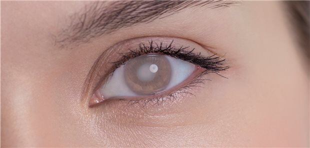 Erblindung kann eine Komplikation bei Großgefäßvaskulitis sein (Symbolbild).