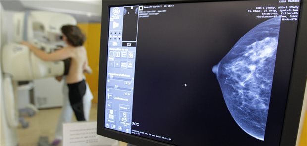 Erfolgsfaktor Screening: 2021, im zweiten Jahr der Pandemie, nahmen erstmals über drei Millionen Frauen am Mammographie-Screening teil.