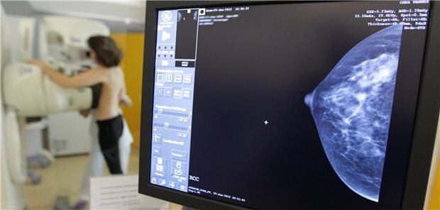 Pandemie hat Brustkrebsdiagnostik nicht gravierend verschleppt Erfolgsfaktor Screening: 2021, im zweiten Jahr der Pandemie, nahmen erstmals über drei Millionen Frauen am Mammographie-Screening teil.