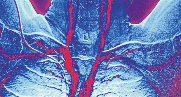 Ergebnisse einer kanadischen Studie sprechen nicht für einen Stent bei Patienten mit asymptomatischer Karotisstenose.