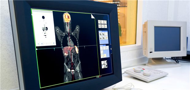 Ergebnisse eines PET/CT-Scans sind auf einem Monitor