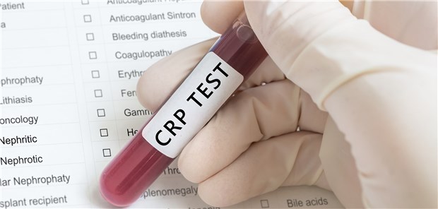 Erhöhte Entzündungsmarker können Ärzte schon mal auf die falsche Fährte locken.