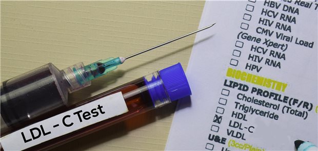 Erhöhtes LDL-C: Für die medikamentöse Therapie gibt es außer Statinen einige weitere Optionen.