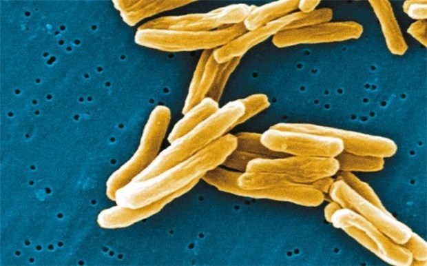 Der Kenntnisstand zu Tuberkulose ist in Deutschland eher gering Erreger der Tuberkulose: Gram-positive Mycobacterien unter dem Raster-Elektronen-Mikroskop. © Janice Carr