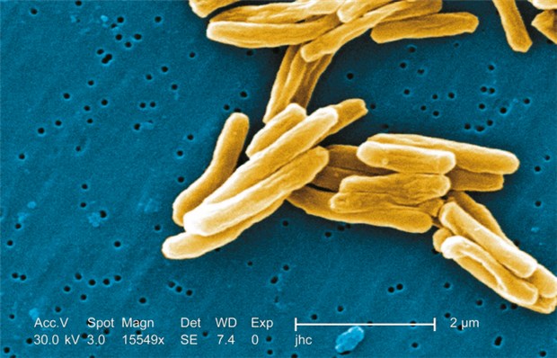 Tipps zur sicheren Tuberkulosediagnostik Erreger der Tuberkulose: grampositive Mykobakterien unter dem Raster-Elektronen-Mikroskop. © Janice Carr