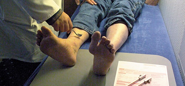Ausheilung oder schwere Folgen Erste Checks bei fraglicher Neuropathie: Liegt ein CRPS vor?