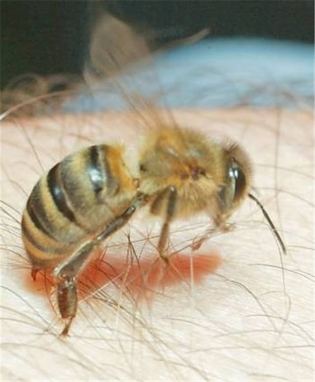 Unverzichtbar: Schulung zu Notfallsets Erstrebenswert für Menschen mit Insektengiftallergie: im Notfall richtig zu reagieren.
