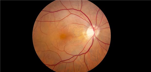 Es ergab sich bei Menschen mit einer chronischen Nierenkrankheit gegenüber Menschen mit gesunden Nieren eine um 46 Prozent signifikant höhere Assoziation mit einer fortgeschrittenen altersbedingten Makuladegeneration (AMD). (Symbolbild)