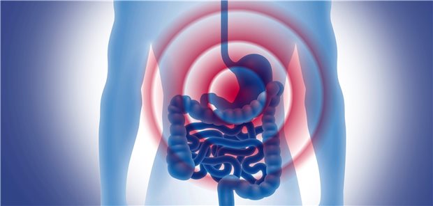 Es gibt neue Hinweise auf eine Schutzwirkung von ASS in puncto Darm- und Magentumoren. Der Effekt ist bei höheren Dosierungen offenbar am größten.