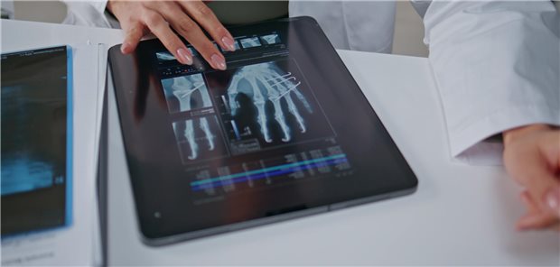Nahaufnahme, wie eine Ärztin die Röntgenbilder einer linken Hand auf einem Tablet in der Klinik analysiert. 