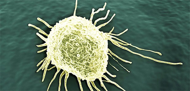 Abwehr gegen Krebs wird scharfgemacht Es zeichnet sich ab, dass sich gegen Krebszellen eine personalisierte Immuntherapie entwickeln wird, die helfen kann, wo Standardtherapien versagen.