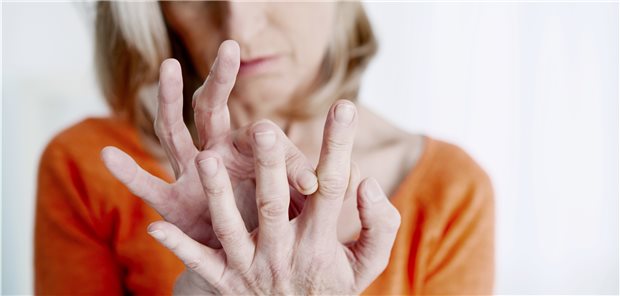 Etwa 80 Prozent der Patienten mit Rheumatoider Arthritis leiden an mindestens einer Begleiterkrankung.
