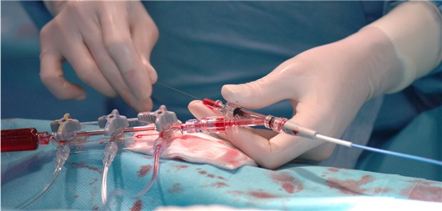 Etwa 900000 Linksherzkatheter-Untersuchungen werden in Deutschland jährlich durchgeführt.