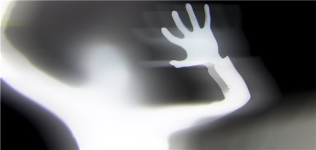 Psychose oder beginnende Demenz? Etwa ein Drittel der Alzheimerpatienten entwickeln im Verlauf ihrer Erkrankung Wahnvorstellungen.