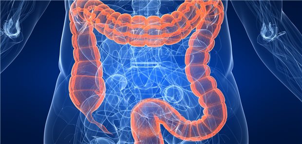 Eventuell neuer Behandlungsansatz bei Hyperkapnie: Die „Abatmung“ nicht über die Lunge, sondern über den Darm.