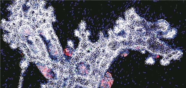 Ex vivo kultivierte embryonale Pankreas-Knospe: Die Behandlung mit dem YAP-Inhibitor Verteporfin führt zur vermehrter Bildung endokriner Zellen (rot).