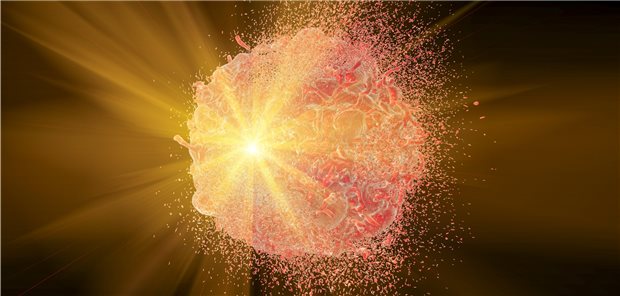 Fallen Leistungen aus dem ursprünglichen Versorgungsauftrag einer Klinik, wie zum Beispiel die Strahlentherapie, durch Schließung entsprechender Einheiten aus, darf nicht mit MVZ kooperiert und das dann auch noch abgerechnet werden, so das BSG.