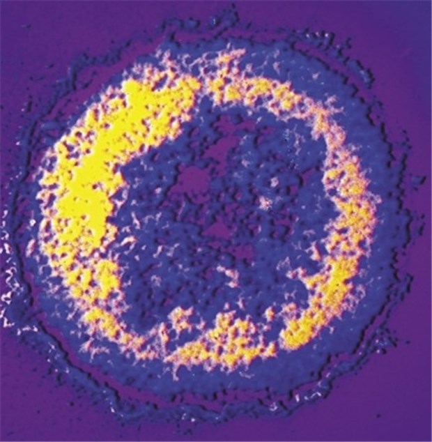 Neuartige Option für HIV-Infizierte Falschfarben-Aufnahme des Aids-Erregers HIV.