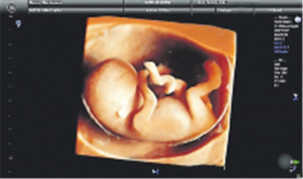 Virtuelle Lichtquelle für die Pränataldiagnostik Faszinierende Einblicke für die Frühdiagnostik.