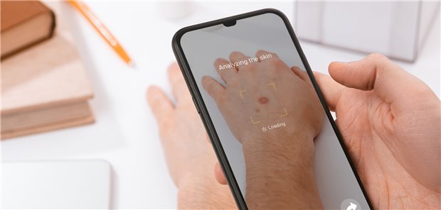 Ferndiagnose möglich? Das schnell aufgenommene Foto, sei es via App oder über einen anderen Weg, das sich eine Hautärztin oder ein Hautarzt anschaut, wird immer beliebter.