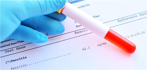Ferritin-Check im Labor: Eisenmangel kann bei Herzinsuffizienz die positiven Remodeling-Effekte einer Resynchronisationstherapie einschränken. Hier hilft einer aktuellen Studie zufolge Eisensubstitution.