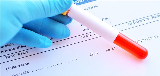 Ferritin-Check im Labor: Fast zwei Drittel der Studienteilnehmerinnen und Studienteilnehmer hatte einen absoluten Eisenmangel.