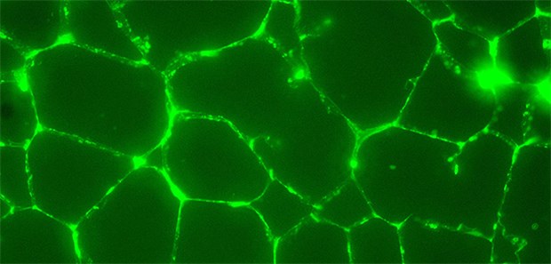 Hormon bremst Schäden durch zu viel Fettgewebe Fettgewebe im histologischen Schnitt. Die Zellwände sind durch einen grün fluoreszierenden Farbstoff markiert (mikroskopische Aufnahme)