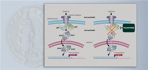 Filgotinib greift in den Entzündungsprozess ein, indem es den JAK-STAT-Signalweg hemmt und so die Transkription inflammatorischer Zytokine herunterreguliert.