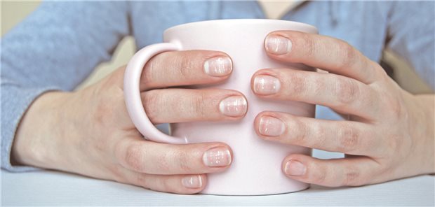 Fingernägel mit Leukonychie können auf Eisenmangel hindeuten.