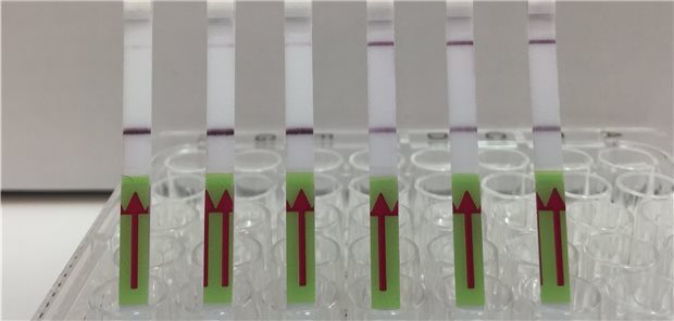 Neuer Test zeigt Abstoßung von Nierentransplantat an Flow Assay: Die Streifen zeigen drei Proben von Patienten, die negativ für das BK-Virus sind (13, 14, 15) und drei Proben, die positiv sind (16, 17, 18). Die obere Bande zeigt dabei ein positives Testergebnis an.