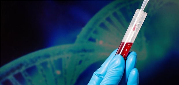 Flüssigbiopsien als diagnostische Testungen öffnen das Tor zur personalisierten Krebsbehandlung.