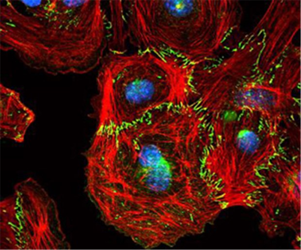 Tumoren: Raf-1 soll Nährstoffzufuhr kappen Fluoreszenzaufnahme von Endothelzellen: VE-Cadherin (grün) reicht durch die Zellmembranen. Es ist mit dem Zytoskelett verbunden (rot). Der Zellkern ist blau gefärbt.