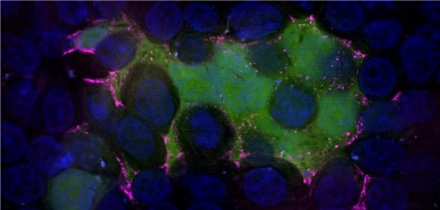 Fluoreszenzmikroskopie bei der Suche nach einem passenden Wirkstoff gegen RSV