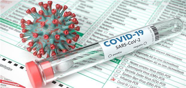 SARS-CoV-2-Testung: Immer noch Ärger mit den Laboraufträgen Formulare, Formulare – welches darf‘s denn sein? Das hängt vom Anlass zur Testung auf SARS-CoV-2 ab. Die Sache gestaltet sich für Vertragsärzte nicht trivial.