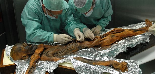 Dies war Ötzis letzte Mahlzeit Forscher bei der Probenahme des Mageninhaltes der Mumie: Ötzi hat nach Ansicht zahlreicher Forscher vor allem fettreich gegessen.