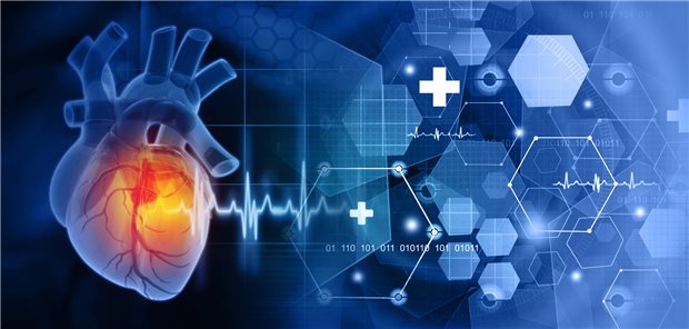 Forschung zur Herzinsuffizienztherapie: Sollten Patienten mit SGLT2-Hemmern eine I.v.-Eisentherapie bekommen? Ein Kardiologe sieht das anders.