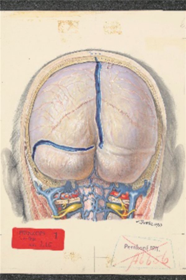 Das moralische Dilemma mit dem Pernkopf-Atlas Franz Batke fertigte viele Bilder des menschlichen Gehirns an (Bd. 4, 1. Ausgabe; pp. 206–207).