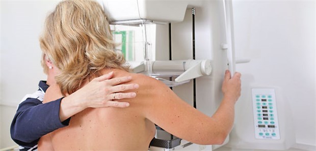Frau bei der Mammografie: Wie viel bringt das Screening?