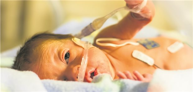 Mindestmengen können Frühchen das Leben retten Frühgeborenes Baby: Eine Studie zeigt, höhere Mindestmengen in Perinatalzentren der Maximalversorgung könnten wohl einige Leben retten.
