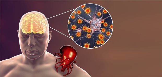 Deutlicher Anstieg von FSME-Fällen in der Schweiz Frühsommer-Meningoenzephalitis: In der Schweiz zählen alle Kantone außer Genf und Tessin zu den FSME-Risikogebieten.