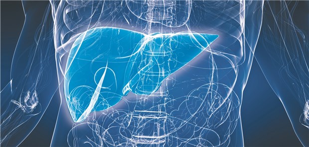 Fünf bisher nicht beschriebene Assoziationen mit der Entwicklung eines hepatozellulären Karzinoms haben die Wissenschaftler entdeckt.